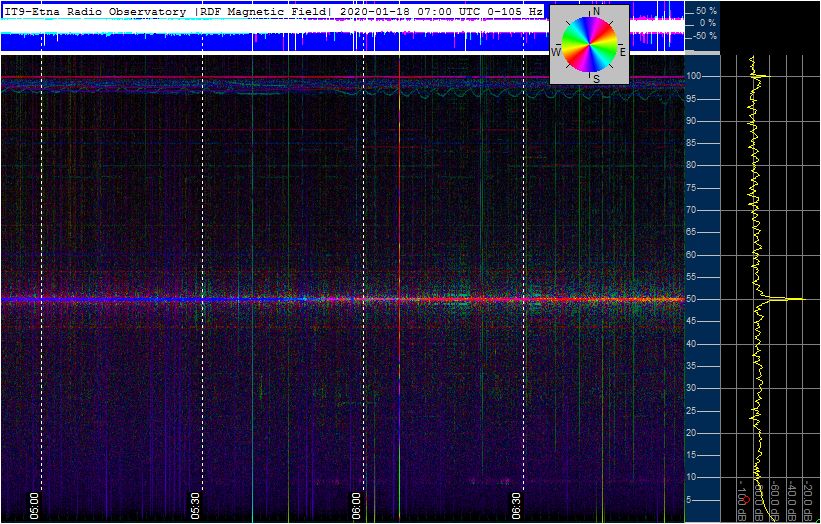1-17-20-ortholoop_2h